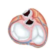 Mitral Mitral