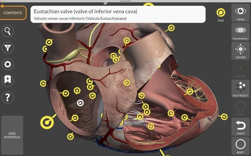 Anatomy 3D Atlas应用截图