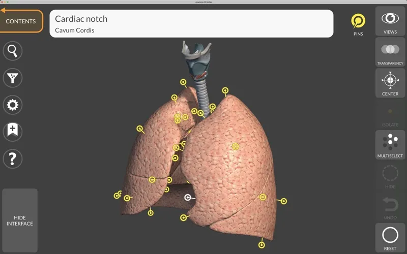 Anatomy 3D Atlas应用截图