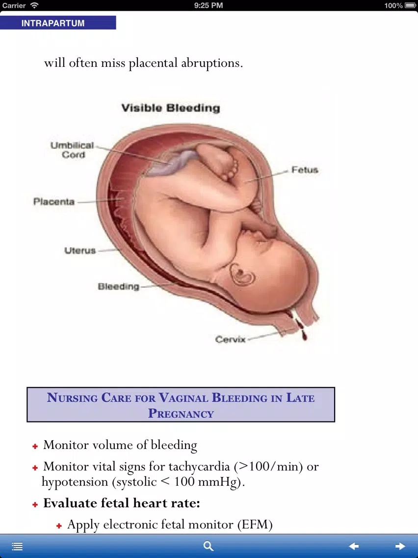 Tangkapan layar Obstetrics and Gynecology Nursing Manual iPad 