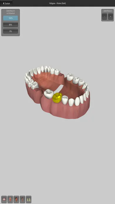 CGM VISODENT 3D App স্ক্রিনশট