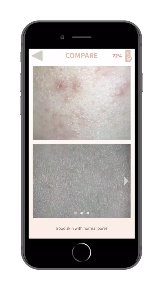 Capturas de pantalla de DermoPico Skin New