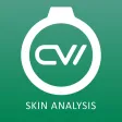 Chowis Skin