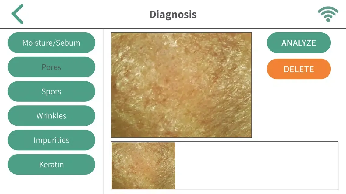 Chowis Skin Screenshots