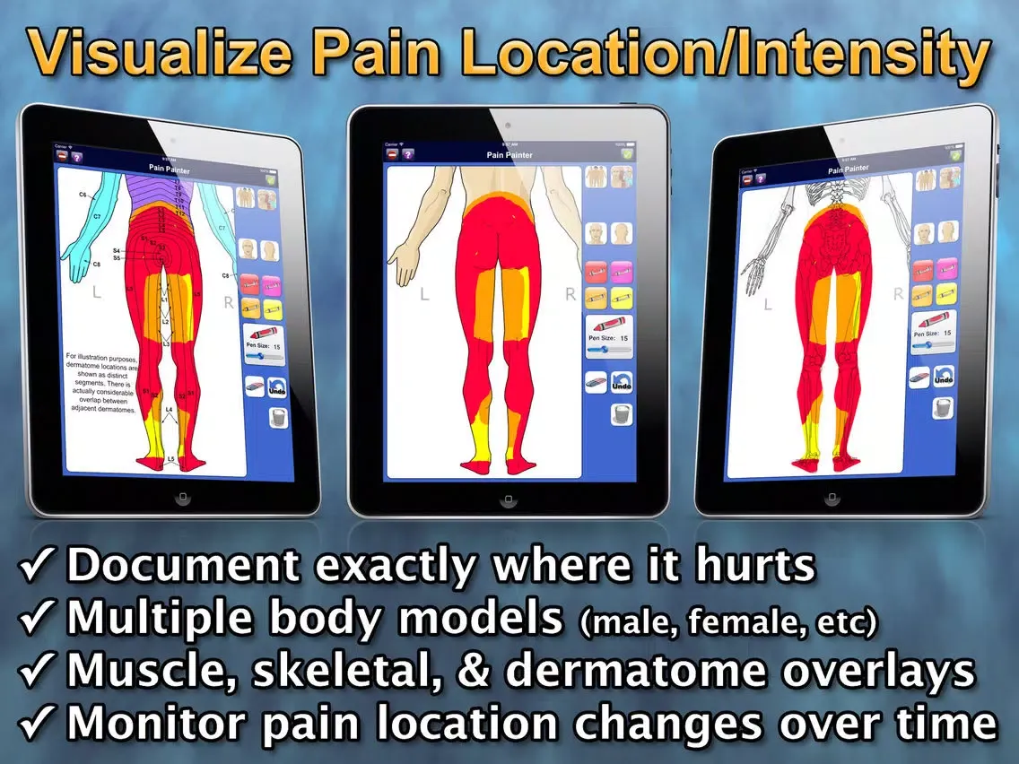 Chronic Pain Tracker iPad  スクリーンショット