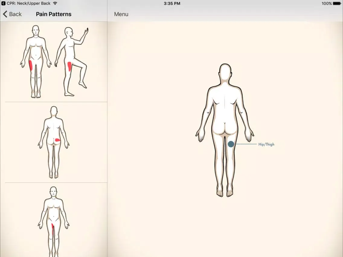 Clinical Pattern Recognition: Hip and Thigh Pain iPad  스크린샷