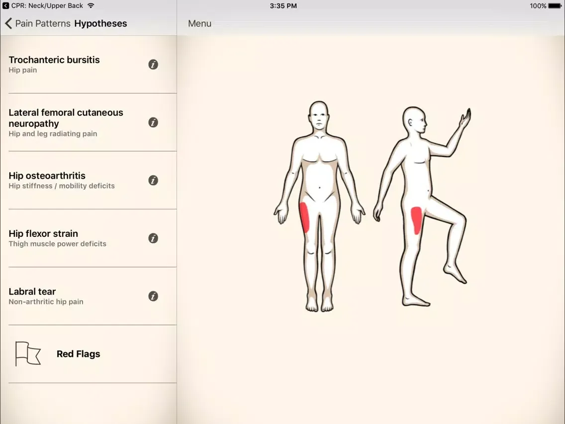 Clinical Pattern Recognition: Hip and Thigh Pain iPad  스크린샷