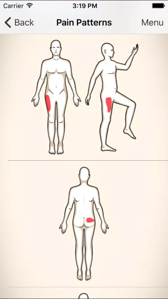 Clinical Pattern Recognition: Hip and Thigh Pain 스크린샷