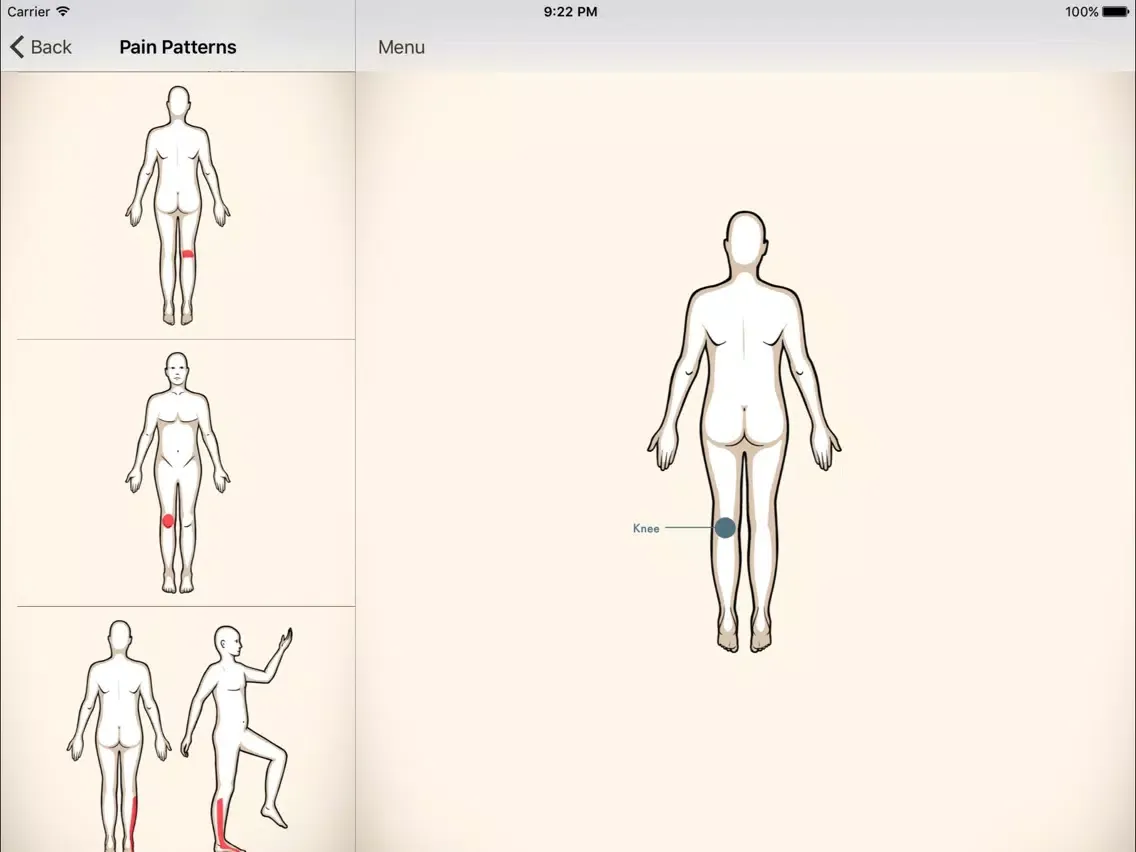 Clinical Pattern Recognition: Knee pain iPad  スクリーンショット