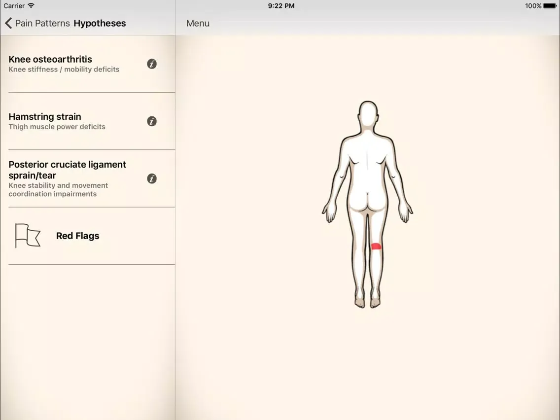 Clinical Pattern Recognition: Knee pain iPad  スクリーンショット