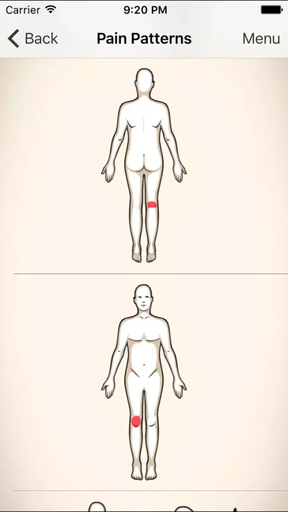 Clinical Pattern Recognition: Knee pain スクリーンショット
