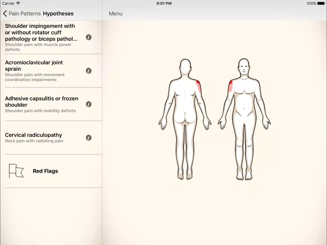 Clinical Pattern Recognition: Shoulder Pain iPad  Ekran Görüntüleri
