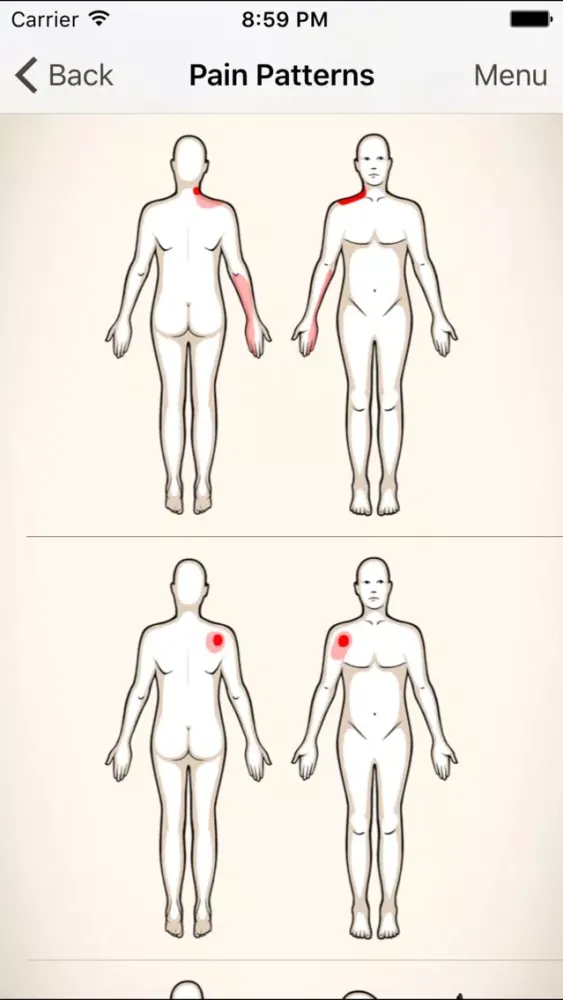 Clinical Pattern Recognition: Shoulder Pain Ekran Görüntüleri