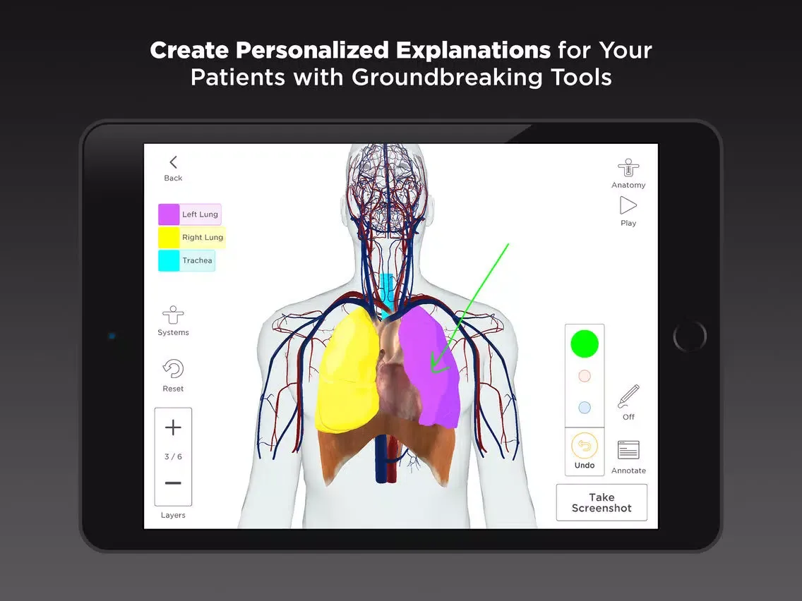 صور COPD Genius iPad 