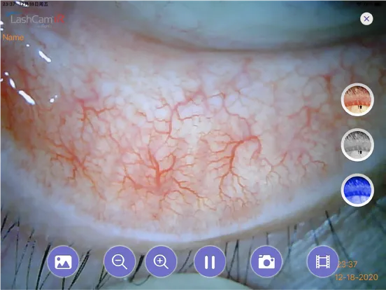 LashCamIR iPad  Screenshots