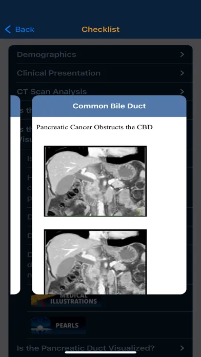 CTisus Pancreas Mass Checklist Screenshots