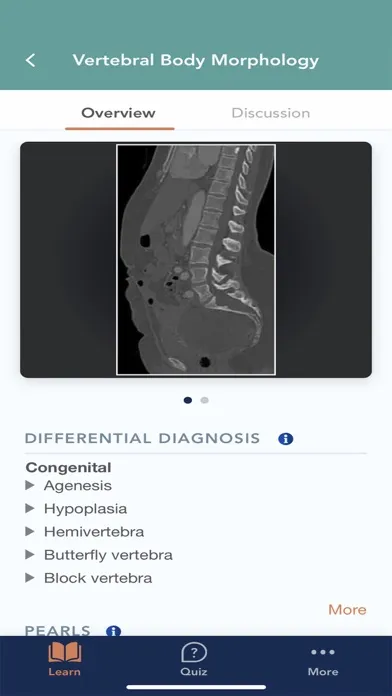 Tangkapan skrin CTisus L-Spine Pathology