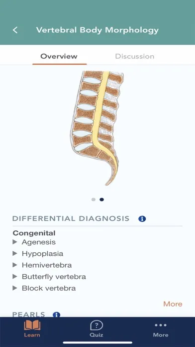 Tangkapan skrin CTisus L-Spine Pathology