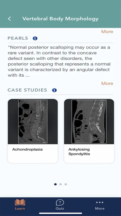 Tangkapan skrin CTisus L-Spine Pathology
