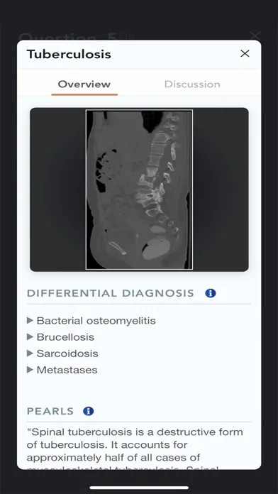 Tangkapan skrin CTisus L-Spine Pathology