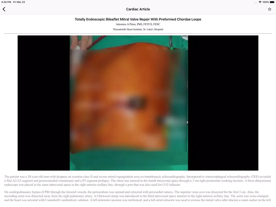 صور CTSNet Videos iPad 