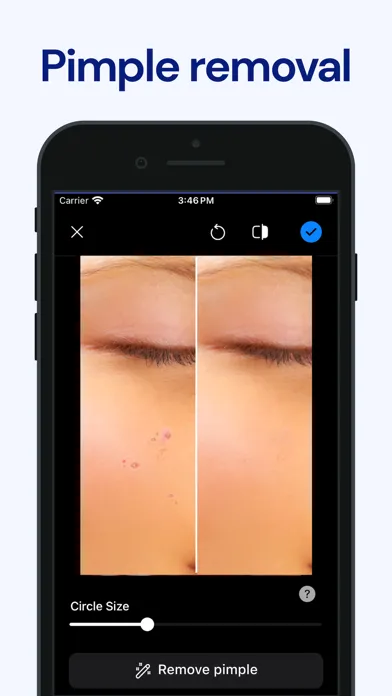 Pimple Remover - Beauty Editor سکرین شاٹس