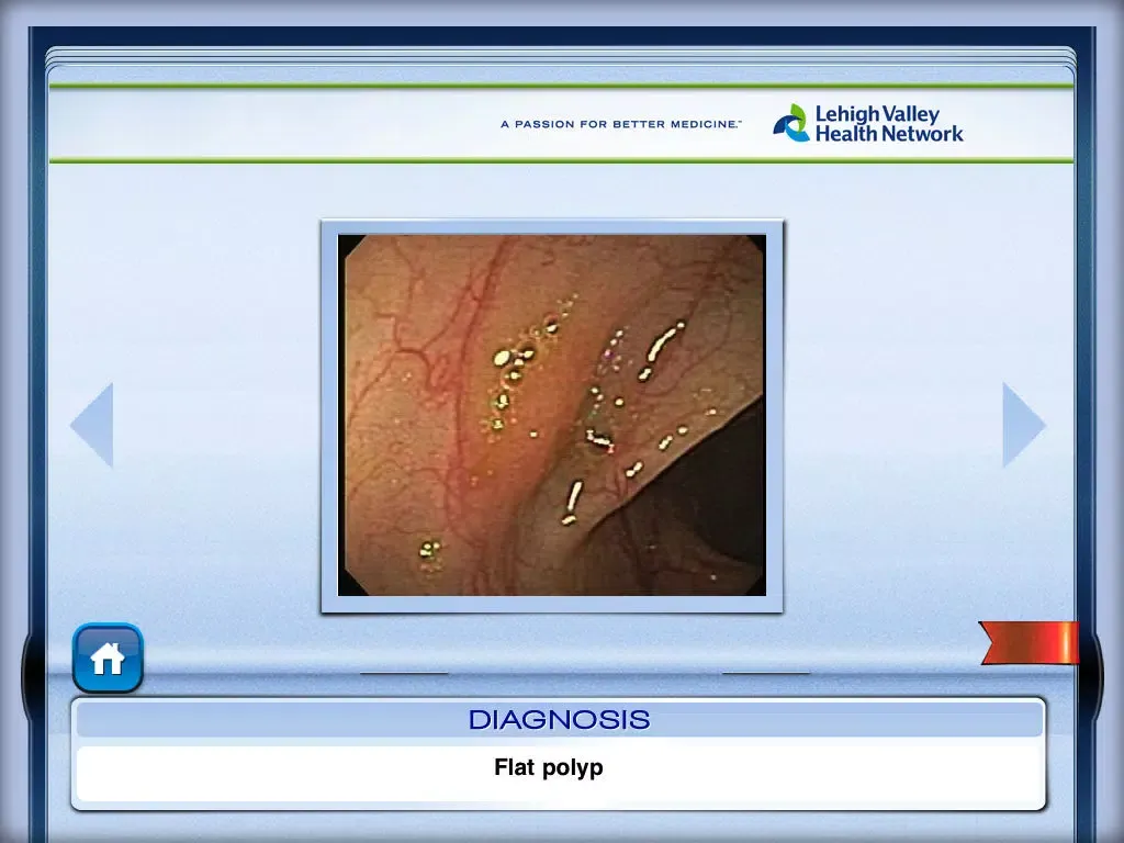 Captures d'écran de Lower Endoscopy iPad 