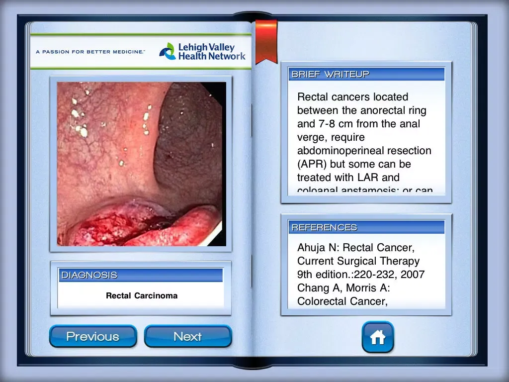 Captures d'écran de Lower Endoscopy iPad 