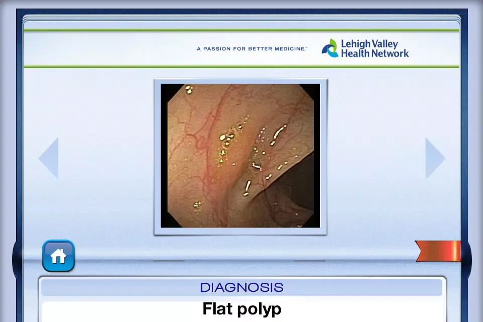 Captures d'écran de Lower Endoscopy