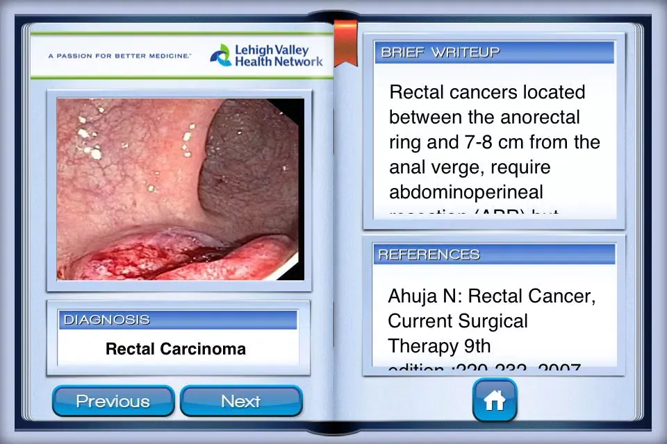 Captures d'écran de Lower Endoscopy
