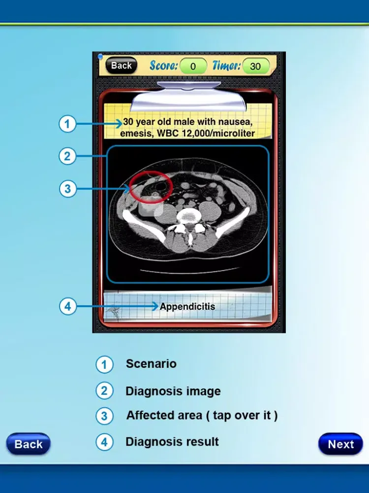 Captures d'écran de Surgical Radiology iPad 