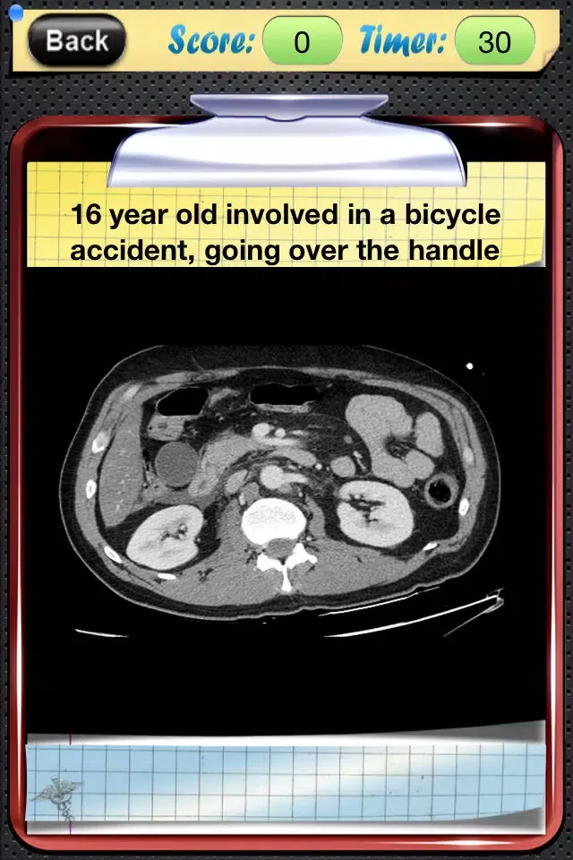 Captures d'écran de Surgical Radiology
