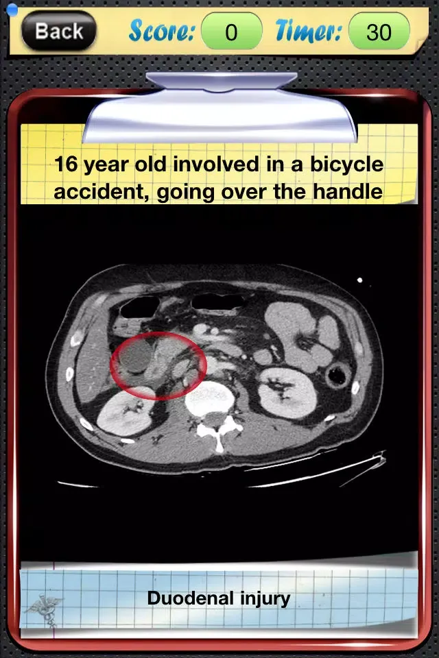 Captures d'écran de Surgical Radiology