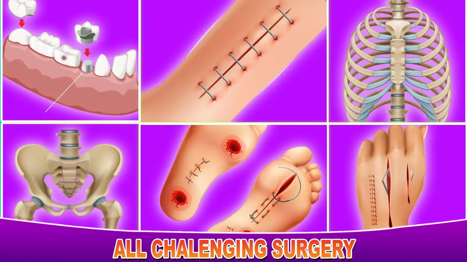 Hospital Open Heart Surgery 스크린샷