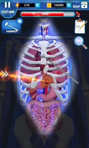 Surgery Master Ekran Görüntüleri