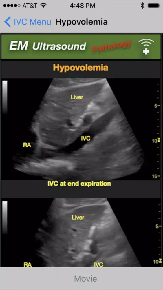 Скриншоты Emergency Medicine Ultrasound