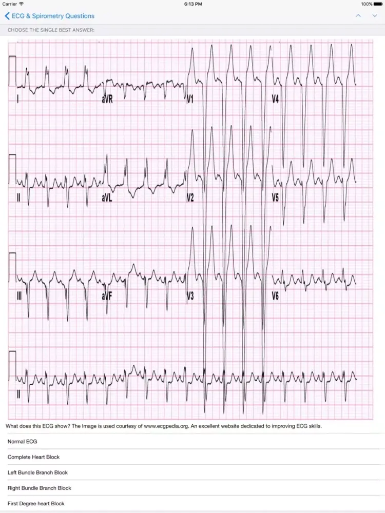iMCQs in General Medicine iPad  Screenshots