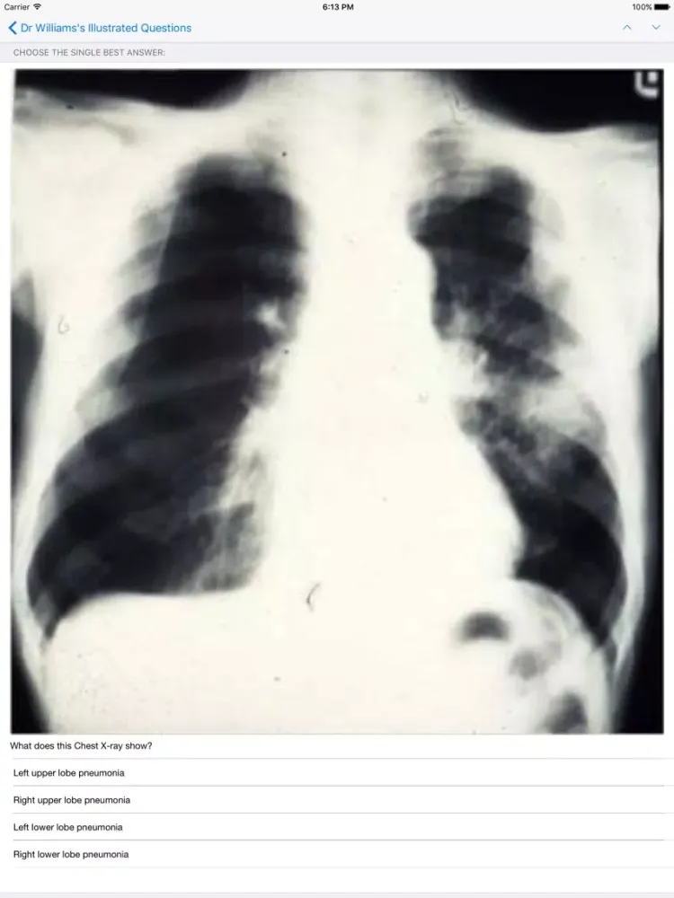 iMCQs in General Medicine iPad  Screenshots