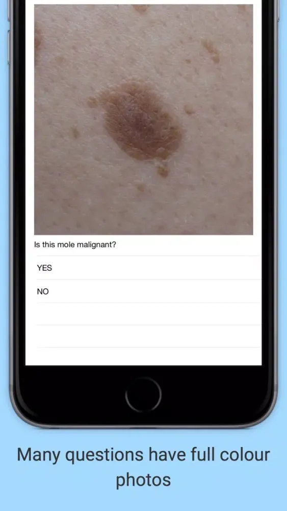 iMCQs in General Medicine Screenshots