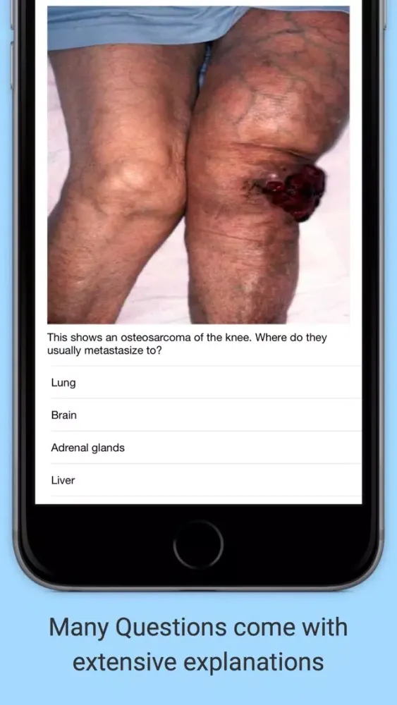 iMCQs in General Medicine Screenshots