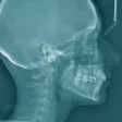 Oral Radiology