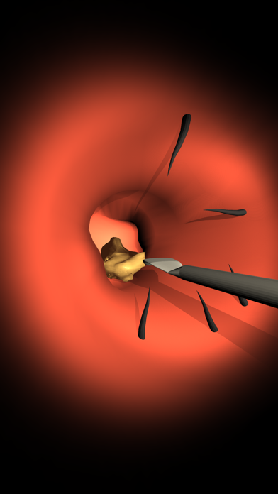 Endoscope cleaning ear Screenshots
