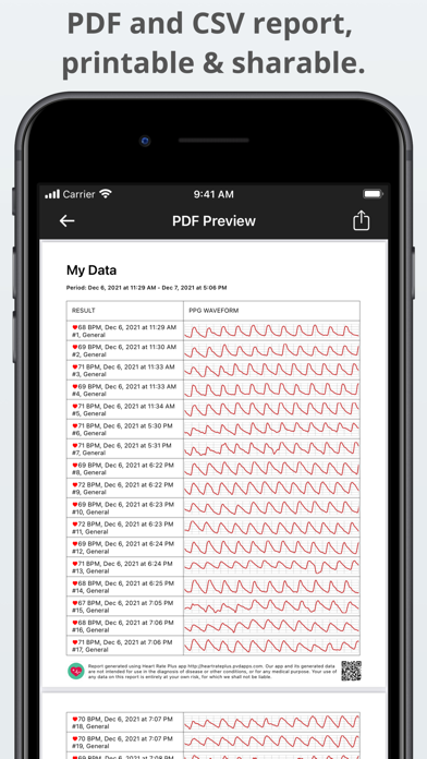 Captures d'écran de Heart Rate Plus: Pulse Monitor