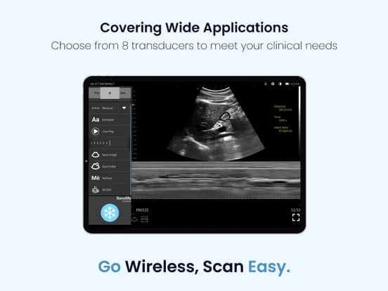 SonoMe Pro iPad  Screenshots