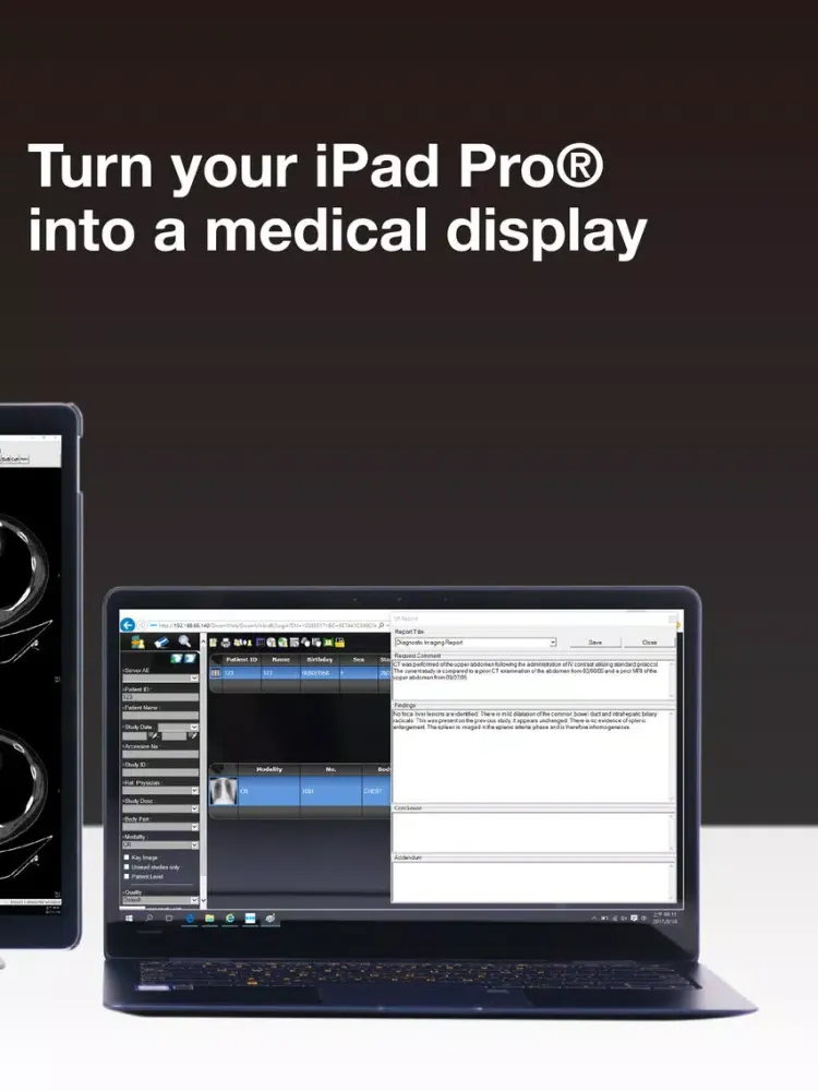 تصاویر Rad@ iPad 