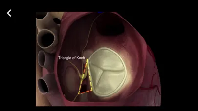 Mitral & Tricuspid Valves স্ক্রিনশট