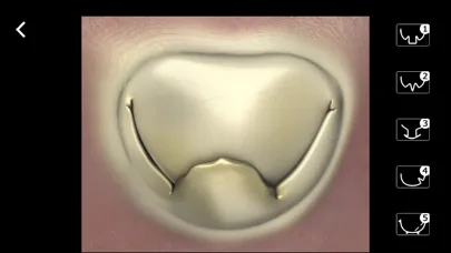 Mitral & Tricuspid Valves স্ক্রিনশট