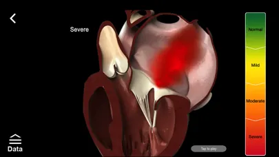 Mitral & Tricuspid Valves স্ক্রিনশট