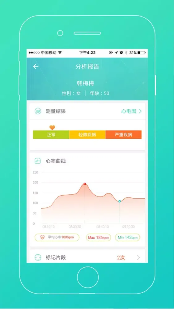 Скриншоты 随心宝-实时监测心脏健康