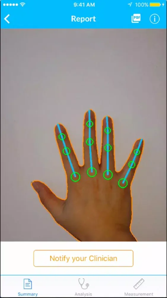 Скриншоты LiveWith Arthritis